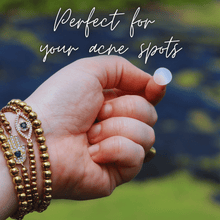 Load image into Gallery viewer, Spot Treatment Hydrocolloid Patches (48 patches)